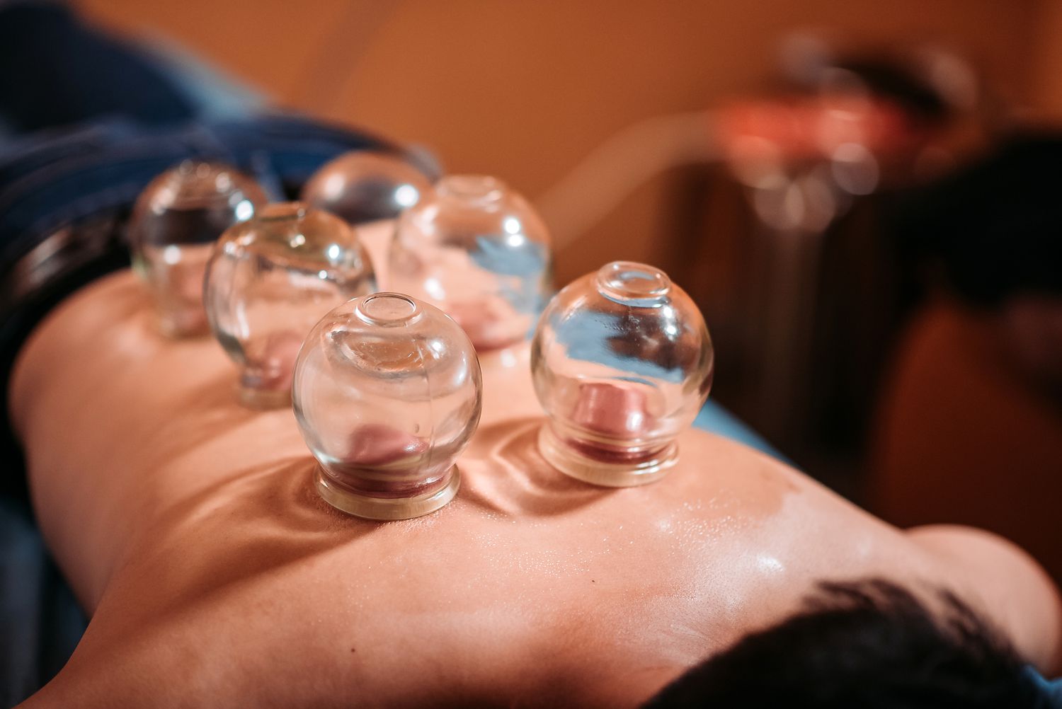 cuppingImage